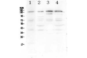 Western blot analysis of EPS15 using anti-EPS15 antibody . (EPS15 antibody  (AA 2-88))