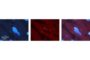 Rabbit Anti-SRSF1 Antibody   Formalin Fixed Paraffin Embedded Tissue: Human heart Tissue Observed Staining: Nucleus Primary Antibody Concentration: 1:100 Other Working Concentrations: N/A Secondary Antibody: Donkey anti-Rabbit-Cy3 Secondary Antibody Concentration: 1:200 Magnification: 20X Exposure Time: 0.