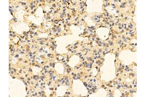 ABIN6263518 and ABIN6273010 at 1/100 staining Rat lung tissue by IHC-P.