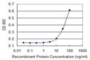 Detection limit for recombinant GST tagged FBXW4P1 is 3 ng/ml as a capture antibody. (FBXW4P1 antibody  (AA 31-130))