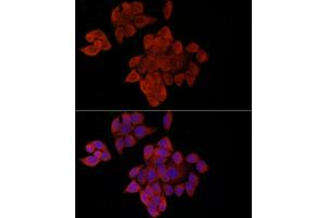 Immunofluorescence analysis of HeLa cells using OP antibody (ABIN6129426, ABIN6145031, ABIN6145032 and ABIN6225150) at dilution of 1:100 (40x lens).