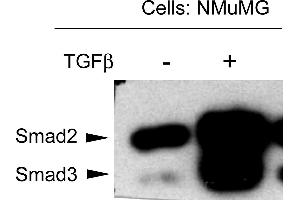 NMuMG mouse mammary epithelial cells were probed for the activation of Smad3 by detecting phosphorylation of threonine 179. (SMAD3 antibody  (Internal Region, pThr179))
