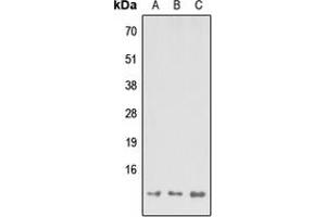 Western blot analysis of MP68 expression in HEK293T (A), Raw264. (C14orf2 antibody  (Center))
