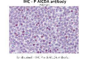 Image no. 1 for anti-Activation-Induced Cytidine Deaminase (AICDA) (N-Term) antibody (ABIN347161) (AICDA antibody  (N-Term))