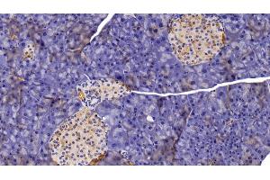 Detection of CHIT1 in Mouse Pancreas Tissue using Polyclonal Antibody to Chitinase 1 (CHIT1) (Chitotriosidase 1 antibody  (AA 210-464))