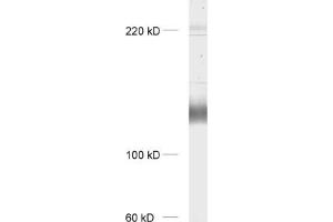 dilution: 1 : 1000, sample: rat brain homogenate (mGluR1 alpha antibody  (AA 1092-1199))