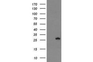 HEK293T cells were transfected with the pCMV6-ENTRY control (Left lane) or pCMV6-ENTRY FXN (Right lane) cDNA for 48 hrs and lysed. (Frataxin antibody)