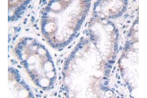 Immunohistochemistry (IHC) image for anti-Low Density Lipoprotein Receptor-Related Protein 4 (LRP4) (AA 1610-1885) antibody (ABIN7435577)