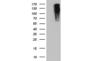 HEK293T cells were transfected with the pCMV6-ENTRY control (Left lane) or pCMV6-ENTRY ENPEP (Right lane) cDNA for 48 hrs and lysed. (ENPEP antibody)