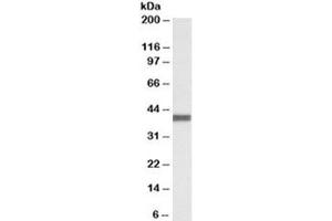 Western blot testing of human breast cancer lysate with CXCR1 antibody at 0. (CXCR1 antibody)