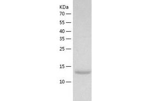 Calmodulin Like Protein 3 (CALML3) (AA 1-149) protein (His-IF2DI Tag)