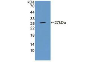 Figure. (ENPEP antibody  (AA 718-948))