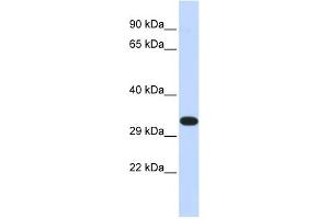 WB Suggested Anti-KIF25 Antibody Titration:  0.