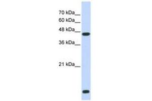 Image no. 1 for anti-Histone Deacetylase 8 (HDAC8) (N-Term) antibody (ABIN6742492) (HDAC8 antibody  (N-Term))