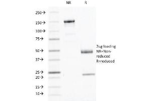 SDS-PAGE Analysis Purified Interferon gamma Mouse Monoclonal Antibody (IFNG/466). (Interferon gamma antibody)