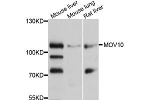 Western blot analysis of extracts of various cell lines, using MOV10 antibody (ABIN1873740) at 1:1000 dilution. (MOV10 antibody)