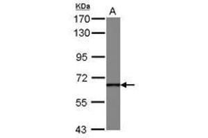Image no. 1 for anti-DEAD (Asp-Glu-Ala-Asp) Box Polypeptide 49 (DDX49) (AA 66-318) antibody (ABIN1497806) (DDX49 antibody  (AA 66-318))