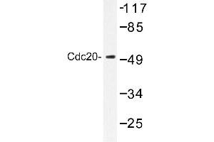 Image no. 1 for anti-Cell Division Cycle 20 Homolog (S. Cerevisiae) (CDC20) antibody (ABIN272282) (CDC20 antibody)