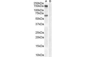 ABIN185506 (1µg/ml) staining of Human Brain lysate (35µg protein in RIPA buffer) with (B) and without (A) blocking with the immunising peptide. (Monoamine Oxidase B antibody  (Internal Region))
