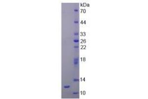 SDS-PAGE analysis of Rat Renin Protein. (Renin Protein (REN))