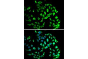 Immunofluorescence analysis of U20S cell using GPS1 antibody. (GPS1 antibody)