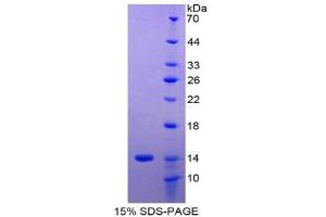 SDS-PAGE (SDS) image for HLA Class I Histocompatibility Antigen, alpha Chain G (HLAG) (AA 29-117) protein (His tag) (ABIN1080240) (HLAG Protein (AA 29-117) (His tag))