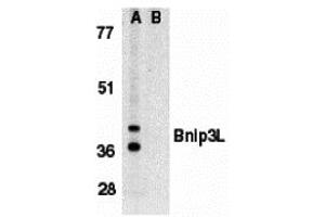 Western Blotting (WB) image for anti-BCL2/adenovirus E1B 19kDa Interacting Protein 3-Like (BNIP3L) antibody (ABIN1031701) (BNIP3L/NIX antibody)