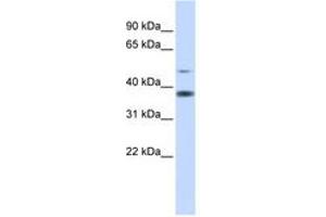 Image no. 1 for anti-Methylmalonic Aciduria (Cobalamin Deficiency) CblD Type, with Homocystinuria (MMADHC) (AA 216-265) antibody (ABIN6741309) (MMADHC antibody  (AA 216-265))