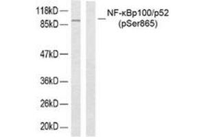 Western blot analysis of extracts from ovary cancer, using NF-kappaB p100/p52 (Phospho-Ser865) Antibody. (NFKB2 antibody  (pSer866))