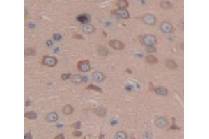 Figure. (EML2 antibody  (AA 1-273))