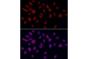 Immunofluorescence analysis of U2OS cells using YE Rabbit pAb (ABIN6130808, ABIN6150331, ABIN6150332 and ABIN6221925) at dilution of 1:50 (40x lens). (GAS41 antibody  (AA 1-227))