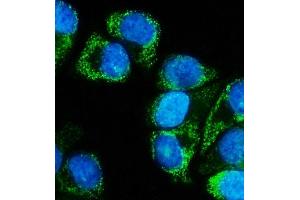 anti-Mitogen-Activated Protein Kinase Kinase 5 (MAP2K5) (AA 9-442) antibody