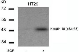 Western Blotting (WB) image for anti-Keratin 18 (KRT18) (pSer33) antibody (ABIN7138559)
