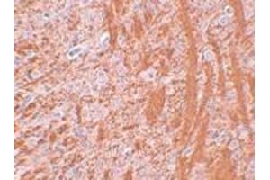 Immunohistochemistry (IHC) image for anti-Jumonji Domain Containing 6 (JMJD6) (N-Term) antibody (ABIN1031427) (JMJD6 antibody  (N-Term))