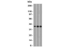 Western blot testing of 1) human HepG2, 2) mouse NIH3T3 and 3) mouse C2C12 lysate with CCND1 antibody. (Cyclin D1 antibody)