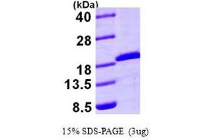 SDS-PAGE (SDS) image for Ubiquitin-Conjugating Enzyme E2A (ube2a) (AA 1-152) protein (His tag) (ABIN666994)