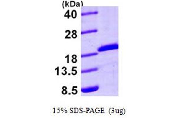 UBE2A Protein (AA 1-152) (His tag)