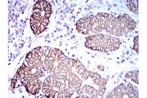 Immunohistochemical analysis of paraffin-embedded stomach tissues using CK5 mouse mAb with DAB staining. (Cytokeratin 5 antibody  (AA 316-590))