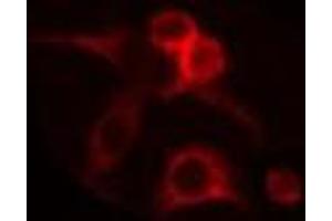 ABIN6275277 staining RAW264. (CYB5R1 antibody  (C-Term))