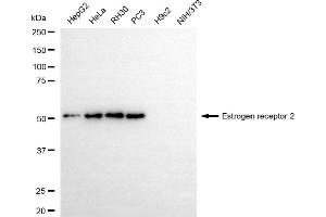 Western blotting analysis using estrogen receptor 2 antibody (ABIN7798494).