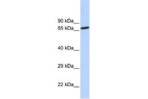 WB Suggested Anti-ZNF571 Antibody Titration:  0. (ZNF571 antibody  (N-Term))