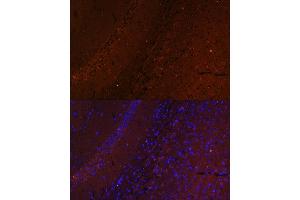 Immunofluorescence analysis of mouse brain using RUSC1 antibody (ABIN7270114) at dilution of 1:100.