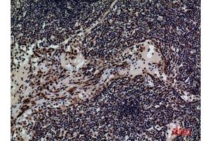 Immunohistochemistry (IHC) image for anti-CD79b Molecule, Immunoglobulin-Associated beta (CD79B) (Internal Region) antibody (ABIN6287313)
