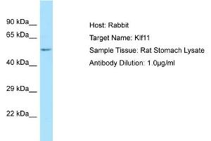 WB Suggested Anti-Klf11 Antibody   Titration: 1. (KLF11 antibody  (N-Term))