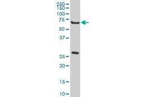 Western Blotting (WB) image for anti-WAS Protein Family, Member 2 (WASF2) (AA 73-173) antibody (ABIN961295) (WASF2 antibody  (AA 73-173))