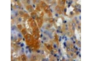 Used in DAB staining on fromalin fixed paraffin-embedded Kidney tissue (TGFB3 antibody  (AA 274-372))