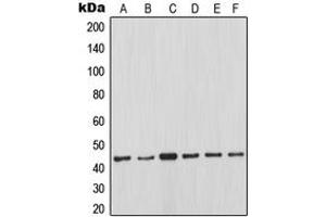 Western blot analysis of MCL1 expression in Ramos (A), JAR (B), K562 (C), Jurkat (D), Raji (E), HeLa (F) whole cell lysates.