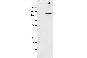 Western blot analysis of JAK2 expression in K562 whole cell lysates,The lane on the left is treated with the antigen-specific peptide.