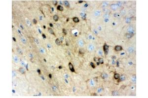 IHC analysis of Stathmin 1 using anti-Stathmin 1 antibody (ABIN3043301). (Stathmin 1 antibody  (N-Term))