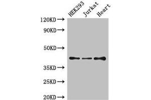 Western Blot Positive WB detected in: HEK293 whole cell lysate, Jurkat whole cell lysate, Mouse heart tissue All lanes: S1PR5 antibody at 4 μg/mL Secondary Goat polyclonal to rabbit IgG at 1/50000 dilution Predicted band size: 42, 33 kDa Observed band size: 42 kDa (S1PR5 antibody  (AA 309-398))